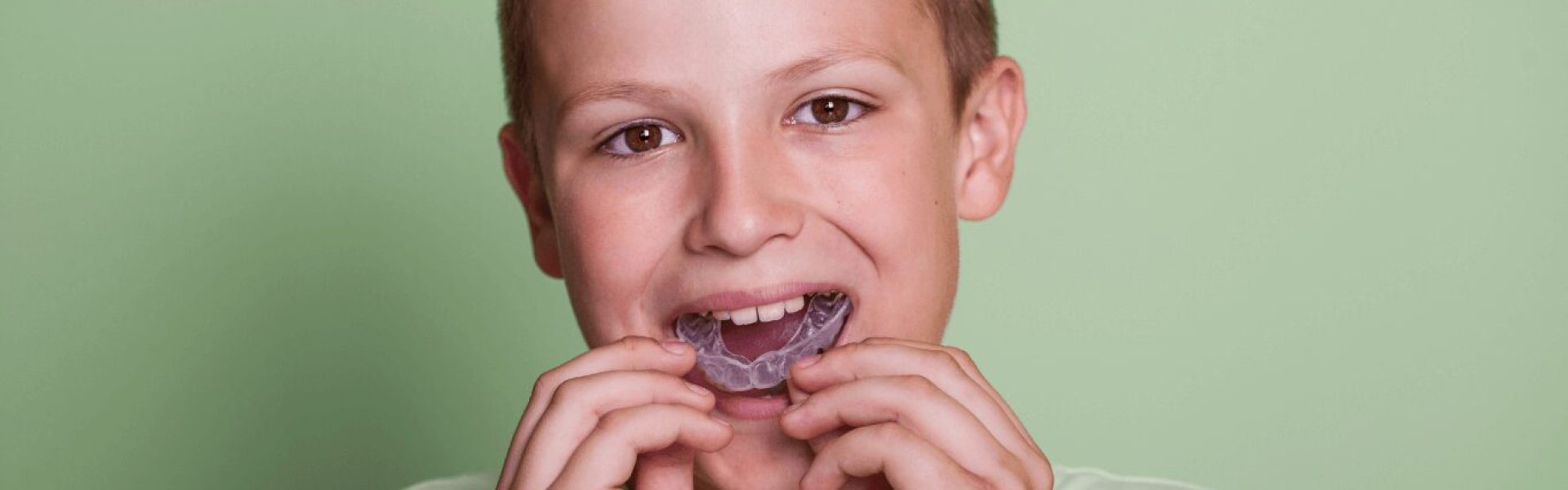 CustomMouthGuard (1)