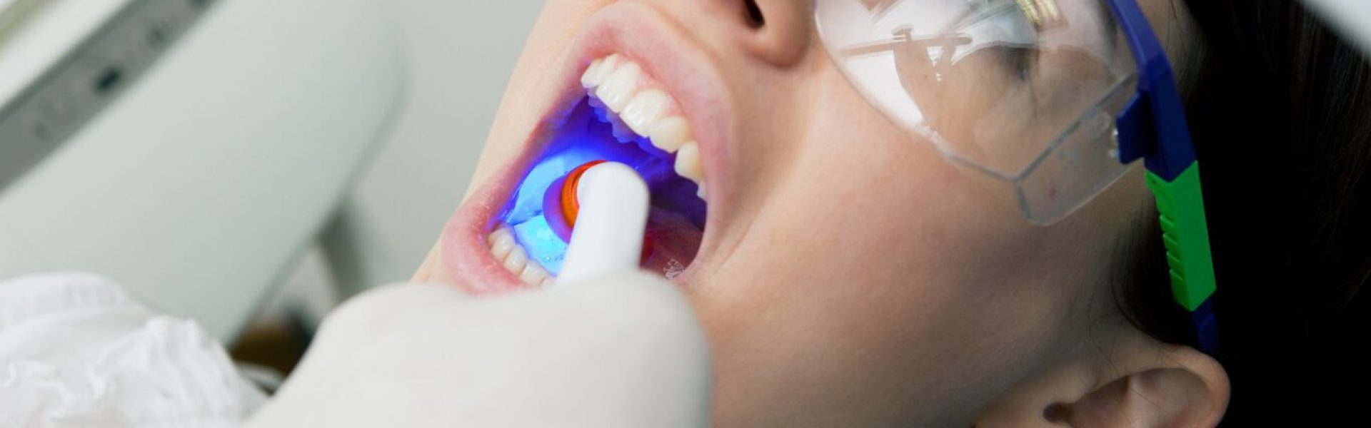 DentalFillings